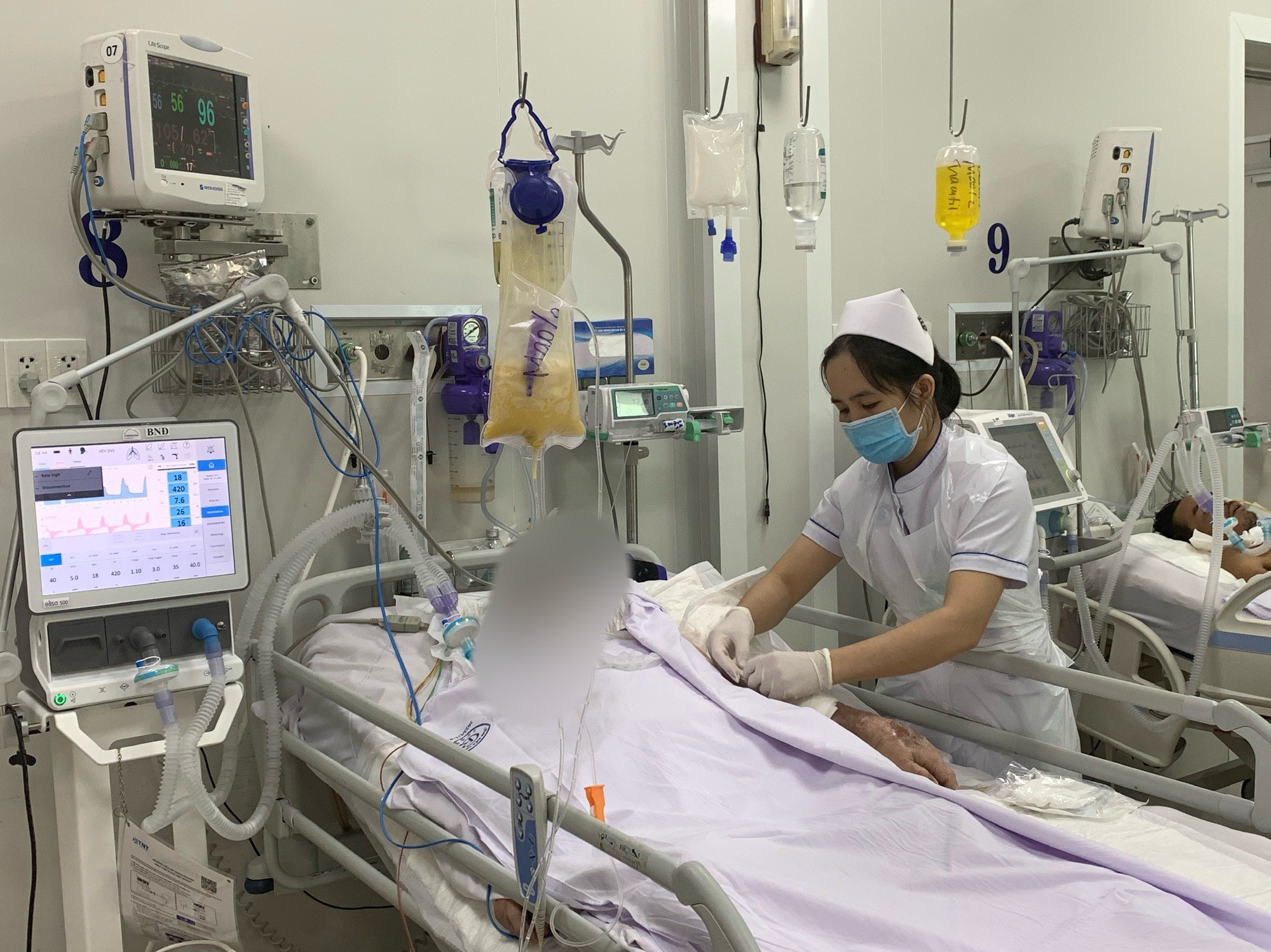 nguoi-nhap-vien-vi-doc-to-botulinum-1684985956.jpg