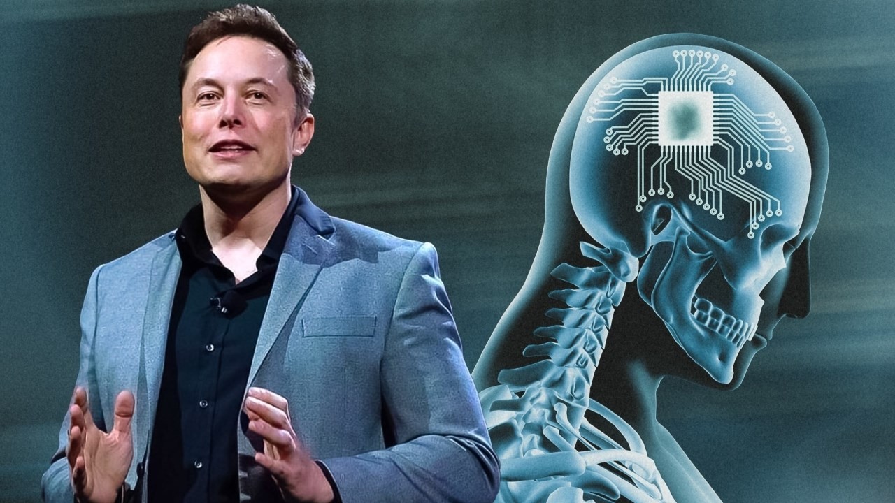 neuralink-implant-4-1706678426.jpg