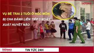 Vụ bé trai 2 tuổi ở Hóc Môn: Bị cha đánh liên tiếp 3 ngày, xuất huyết não