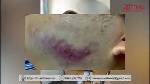Xác minh clip người đàn ông 'tung cước' đá thẳng vào mặt nữ trưởng phòng công chứng