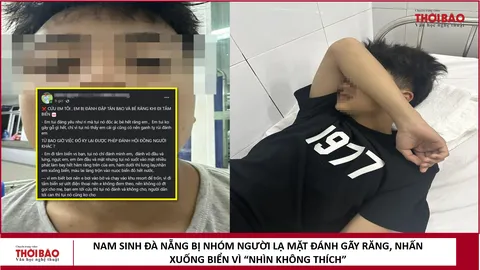 Nam sinh ở Đà Nẵng bị nhóm thanh niên đánh gãy 4 răng, nhấn xuống biển