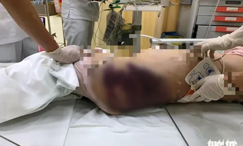 Bé gái 8 tuổi tử vong nghi do 'mẹ kế' bạo hành