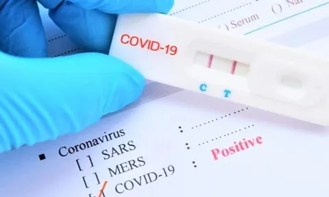 Bộ Y tế: Cơ sở kinh doanh phải niêm yết giá bán kit test Covid-19