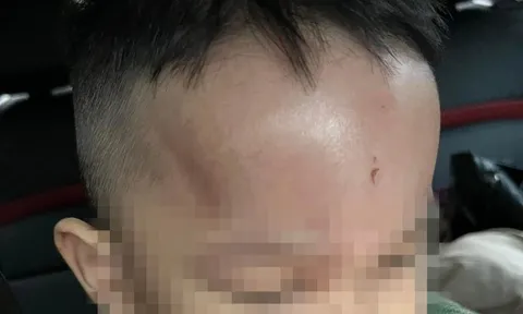 Đà Nẵng: Cơ quan chức năng xác minh vụ việc phụ huynh phản ánh trẻ bị bạo hành
