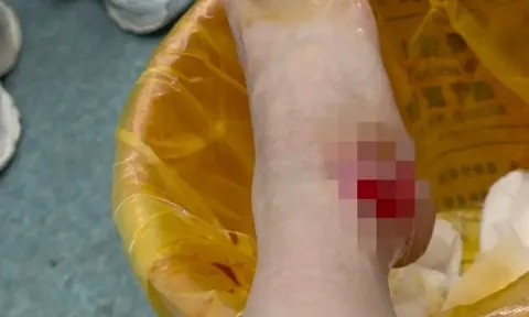 Clip: Cặp đôi hôn nhau đắm đuối trong quán lẩu, chàng trai ngã làm đổ nồi nước sôi khiến cô gái bàn bên bị bỏng