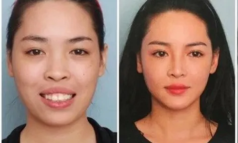 Nhan sắc 'hotgirl phẫu thuật thẩm mỹ' Vũ Thanh Quỳnh thay đổi ra sao sau 7 năm đổi đời?