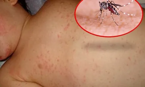 Bà Rịa - Vũng Tàu có thêm 1 ca tử vong do sốt xuất huyết