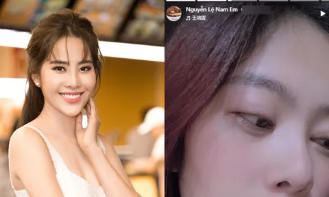 Nam Em khiến fan lo lắng với khoảnh khắc mắt sưng, u sầu