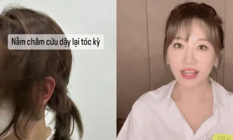 Hari Won tiếp tục điều trị chứng bệnh liệt nửa mặt
