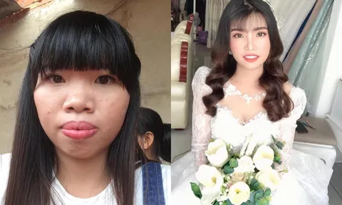 6 năm sau cuộc đại trùng tu nhan sắc, Phượng 'Thị Nở' đổi đời, cuộc sống thăng hoa
