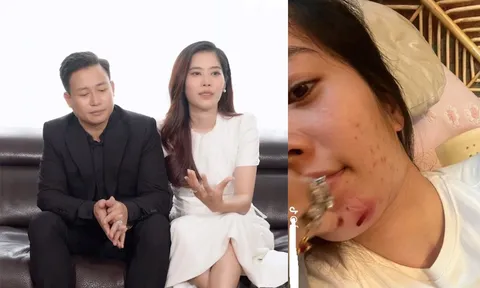 Nam Em tiều tụy khó nhận ra, rơi vào tình cảnh đáng báo động sau thị phi của chồng sắp cưới