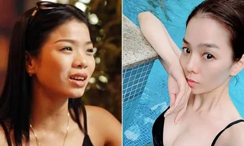 Lệ Quyên thừa nhận 'dao kéo' 1 bộ phận nhỏ trên gương mặt
