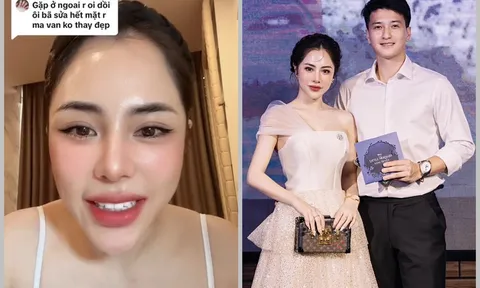 Bạn gái Huỳnh Anh nói gì khi bị chê 'sửa hết mặt vẫn không đẹp' mà cư dân mạng lại tán dương?