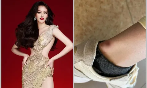 Đặng Thanh Ngân bị thương ở chân nhưng vẫn 'giấu nhẹm' fan để chinh chiến tại Miss Supranational 2023