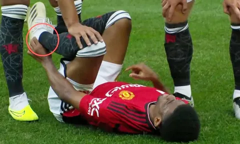 Sao Man United chấn thương tồi tệ, nguy cơ bỏ lỡ cả mùa giải?