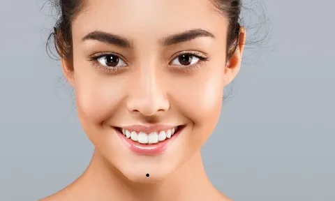 Nhận diện 9 nốt ruồi xấu trên mặt khiến chủ nhân hao tài tốn của, tình duyên lận đận