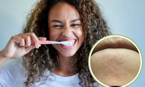 Đánh răng hay rửa mặt trước: Nhiều người làm sai, da xấu đổ tại cơ địa