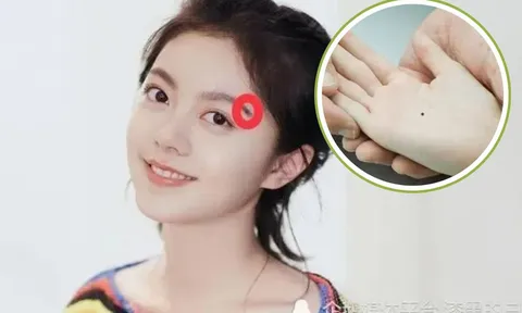 Phụ nữ chỉ cần có 1 trong 5 nốt ruồi quý này thì vận số tụ tài, cả đời không lo cơm ăn áo mặc