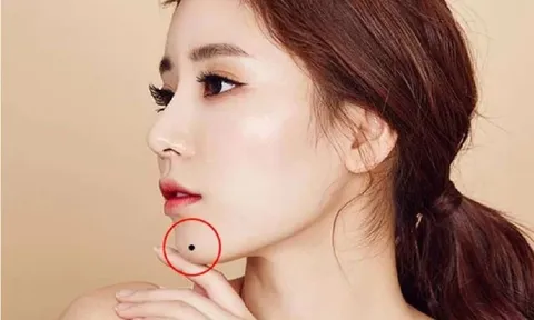 Phụ nữ có 1 trong 4 nốt ruồi đại quý này thì cuộc đời êm đềm, số vượng phu ích tử bao người khao khát