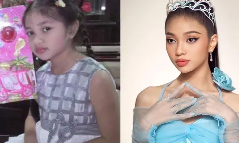 Ảnh hồi nhỏ của Á hậu Minh Kiên giúp cô thoát nghi vấn thẩm mỹ 1 điểm trên mặt
