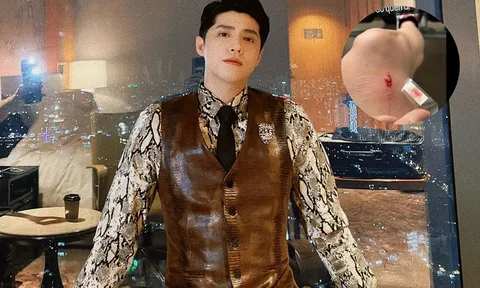 Noo Phước Thịnh gặp thương tích khi vận động khiến fan lo lắng