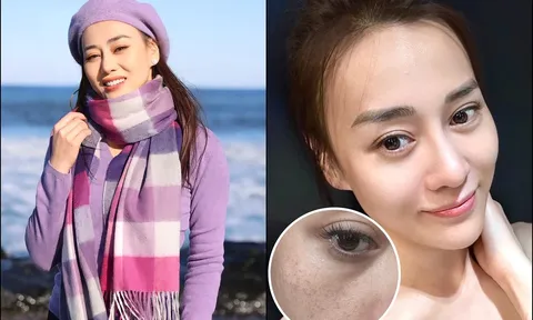 Phương Oanh đau đầu vì 1 vấn đề, hóa ra nhiều chị em mắc phải