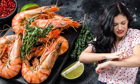 Những ai không nên ăn tôm: Cảnh báo hậu quả tai hại nếu xem nhẹ!