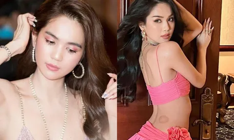 Ngọc Trinh lộ rõ vết bầm lớn trên cơ thể, nguyên nhân khiến dân tình lo lắng