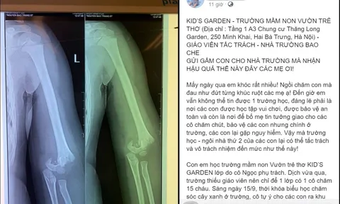 Hà Nội: Mẹ đau đớn vì con gái 5 tuổi ngã gãy khủyu tay trong giờ học, bức xúc "tố" nhà trường thiếu trách nhiệm